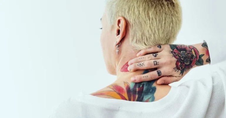 Tattoo Removal Before-and-After